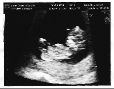 Little Hand