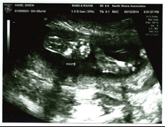 Little Hand