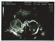 Little Hand